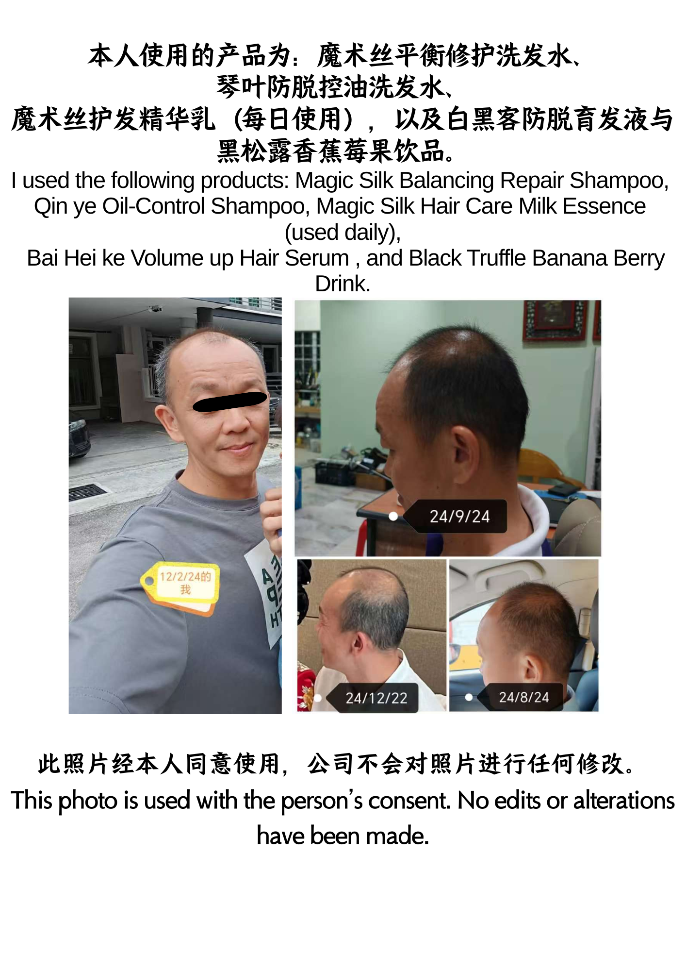 本人使用的产品为：魔术丝平衡修护洗发水、 琴叶防脱控油洗发水、 魔术丝护发精华乳（每日使用），以及白黑客防脱育发液与 黑松露香蕉莓果饮品。