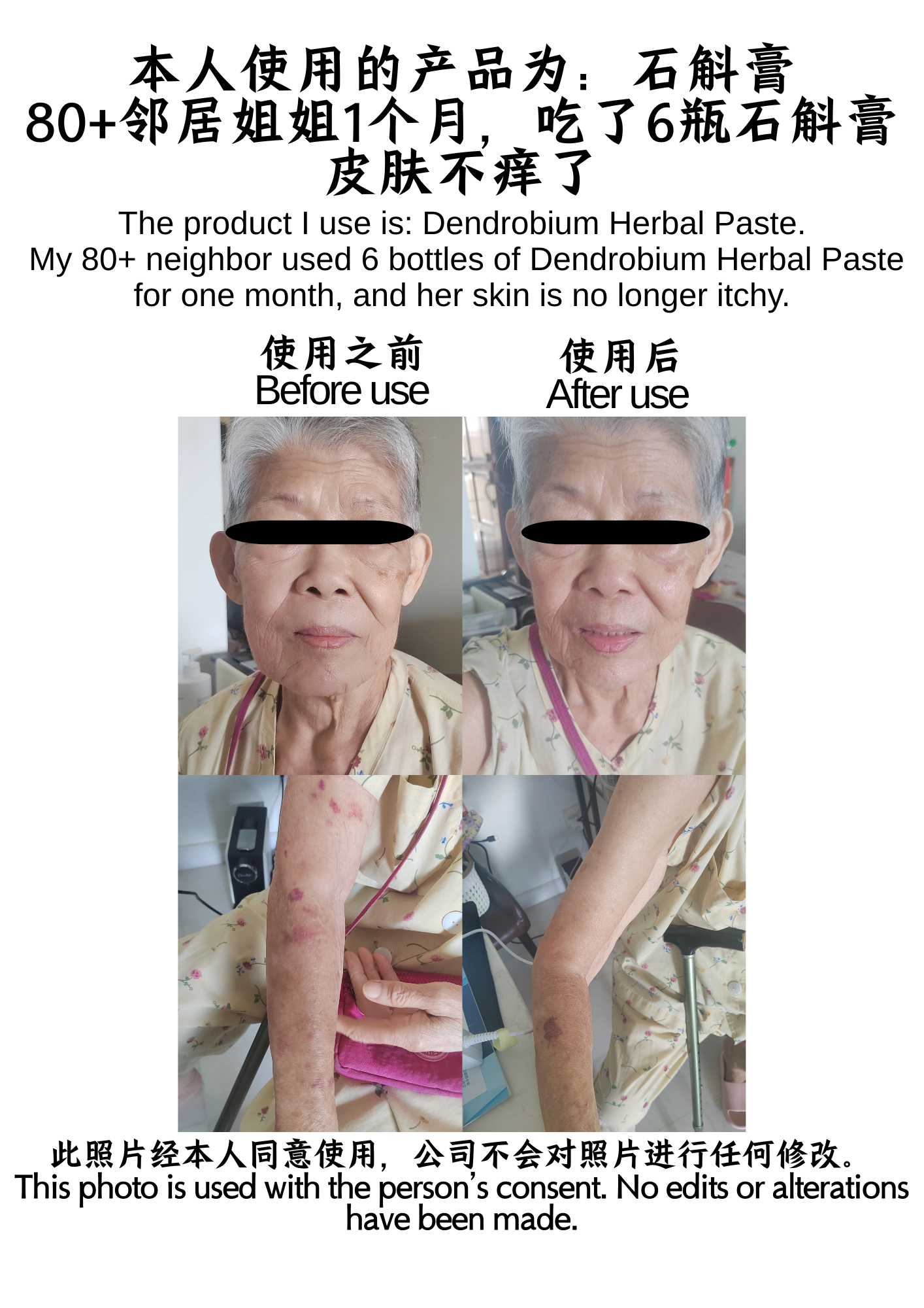 本人使用的产品为：石斛膏  1个月，吃了6瓶石斛膏皮肤不痒了